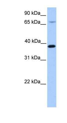 Western Blot: HMBS Antibody [NBP1-56412] - 721_B cell lysate, concentration 0.2-1 ug/ml.