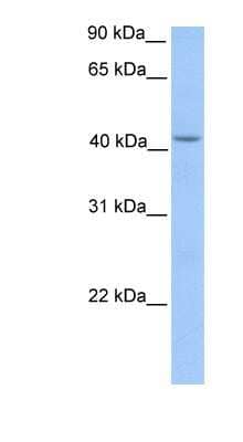 Western Blot: HMBS Antibody [NBP1-56627] - Human Liver cell lysate, concentration 0.2-1 ug/ml.