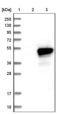 Western Blot: HMBS Antibody [NBP1-87329] - Lane 1: Marker [kDa] 250, 130, 95, 72, 55, 36, 28, 17, 10. Lane 2: Negative control (vector only transfected HEK293T lysate). Lane 3: Over-expression lysate (Co-expressed with a C-terminal myc-DDK tag (3.1 kDa) in mammalian HEK293T cells).