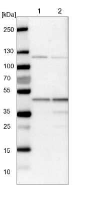 Western Blot: HMBS Antibody [NBP1-87329] - Lane 1: NIH-3T3 cell lysate (Mouse embryonic fibroblast cells). Lane 2: NBT-II cell lysate (Rat Wistar bladder tumor cells).