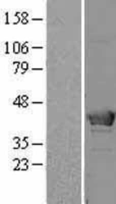 Western Blot: HMBS Overexpression Lysate (Adult Normal) [NBL1-11604] Left-Empty vector transfected control cell lysate (HEK293 cell lysate); Right -Over-expression Lysate for HMBS.