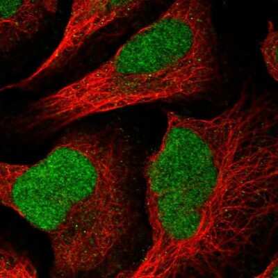 Immunocytochemistry/Immunofluorescence: HMCES Antibody [NBP2-14410] - Staining of human cell line U-2 OS shows localization to nucleus. Antibody staining is shown in green.