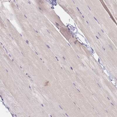 Immunohistochemistry-Paraffin: HMCES Antibody [NBP2-14410] - Staining of human skeletal muscle shows no positivity in myocytes as expected.