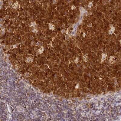 Immunohistochemistry-Paraffin: HMCES Antibody [NBP2-14410] - Staining of human tonsil shows strong nuclear positivity in germinal center cells.