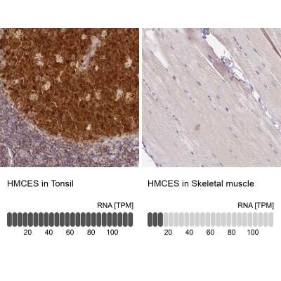 Immunohistochemistry-Paraffin HMCES Antibody - BSA Free