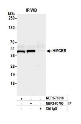 Immunoprecipitation: HMCES Antibody [NBP2-60700] - Detection of human HMCES by western blot of immunoprecipitates. Samples: Whole cell lysate (1.0 mg per IP reaction; 20% of IP loaded) from MCF-7 cells prepared using NETN lysis buffer. Antibodies: Affinity purified Rabbit anti-HMCES antibody NBP2-60700 used for IP at 40 ul per reaction. HMCES was also immunoprecipitated by rabbit anti-HMCES antibody NBP2-76818. For blotting immunoprecipitated HMCES, NBP2-60700 was used at 1:1000. Chemiluminescence with an exposure time of 3 seconds.