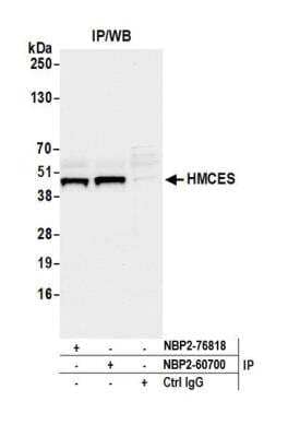 Immunoprecipitation: HMCES Antibody [NBP2-76818] - Detection of human HMCES by western blot of immunoprecipitates. Samples: Whole cell lysate (1.0 mg per IP reaction; 20% of IP loaded) from MCF7 cells prepared using NETN lysis buffer. Antibodies: Affinity purified Rabbit anti-HMCES antibody NBP2-60700 used for IP at 40 ul per reaction. HMCES was also immunoprecipitated by rabbit anti-HMCES antibody NBP2-76818. For blotting immunoprecipitated HMCES, NBP2-76818 was used at 1:100. Detection: Chemiluminescence with an exposure time time of 3 seconds.