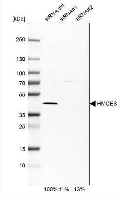 <b>Genetic Strategies Validation and Orthogonal Strategies Validation.</b>Western Blot: HMCES Antibody [NBP2-14410] - Analysis in MCF-7 cells transfected with control siRNA, target specific siRNA probe #1 and #2, using Anti-HMCES antibody. Remaining relative intensity is presented. Loading control: Anti-GAPDH.