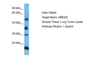 Western Blot: HMCES Antibody [NBP2-87579] - Host: Rabbit. Target Name: HMCES. Sample Type: Lung Tumor lysates. Antibody Dilution: 1.0ug/ml