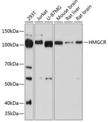 Western Blot: HMG-CoA Reductase/HMGCR Antibody (6Y9L8) [NBP3-15641] - Analysis of extracts of various cell lines, using HMG-CoA Reductase/HMGCR antibody (NBP3-15641) at 1:1000 dilution. Secondary antibody: HRP Goat Anti-Rabbit IgG (H+L) at 1:10000 dilution. Lysates/proteins: 25ug per lane. Blocking buffer: 3% nonfat dry milk in TBST. Detection: ECL Basic Kit. Exposure time: 90s.