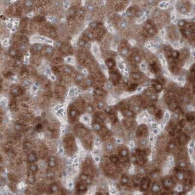 Immunohistochemistry-Paraffin: HMG-CoA Reductase/HMGCR Antibody (CL0259) [NBP2-61616] - Staining of human liver shows strong cytoplasmic immunoreactivity.