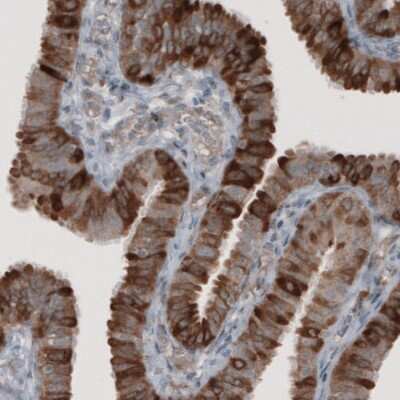 Immunohistochemistry-Paraffin: HMG-CoA Reductase/HMGCR Antibody (CL0259) [NBP2-61616] - Staining of human fallopian tube shows strong cytoplasmic positivity in glandular cells.