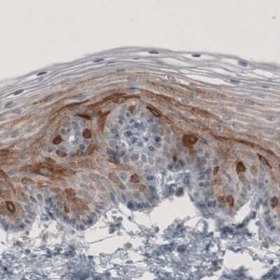 Immunohistochemistry-Paraffin: HMG-CoA Reductase/HMGCR Antibody (CL0259) [NBP2-61616] - Staining of human cervix shows cytoplasmic immunoreactivity in epithelial cells.