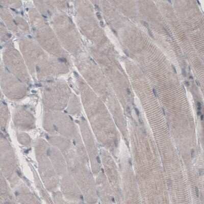 Immunohistochemistry-Paraffin: HMG-CoA Reductase/HMGCR Antibody (CL0259) [NBP2-61616] - Staining of human skeletal muscle shows absence of immunoreactivity (negative control).