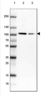 <b>Genetic Strategies Validation. </b>Western Blot: HMG-CoA Reductase/HMGCR Antibody (CL0259) [NBP2-61616] - Lane 1: Marker [kDa] 250, 130, 100, 70, 55, 35, 25, 15, 10 Lane 2: Human cell line MCF-7 Lane 3: Human cell line HepG2