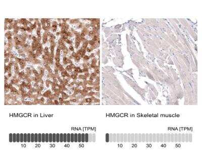 Immunohistochemistry-Paraffin: HMG-CoA Reductase/HMGCR Antibody (CL0260) [NBP2-61617] - Analysis in human liver and skeletal muscle tissues using NBP2-61617 antibody. Corresponding HMGCR RNA-seq data are presented for the same tissues.