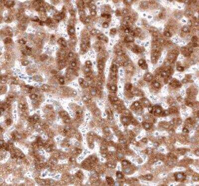 Immunohistochemistry-Paraffin: HMG-CoA Reductase/HMGCR Antibody (CL0260) [NBP2-61617] - Staining of human liver shows moderate cytoplasmic postivity in hepatocytes.