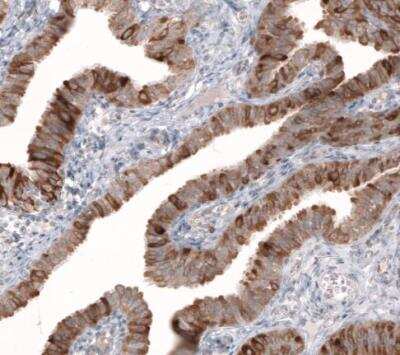 Immunohistochemistry-Paraffin: HMG-CoA Reductase/HMGCR Antibody (CL0260) [NBP2-61617] - Staining of human fallopian tube shows moderate to strong cytoplasmic positivity in glandular cells.