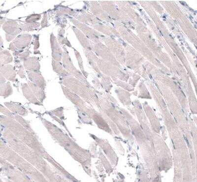 Immunohistochemistry-Paraffin: HMG-CoA Reductase/HMGCR Antibody (CL0260) [NBP2-61617] - Staining of human skeletal muscle shows no positivity in myocytes as expected.