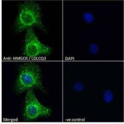 Immunocytochemistry/Immunofluorescence: HMG-CoA Reductase/HMGCR Antibody [NBP3-05292] - Immunofluorescence analysis of paraformaldehyde fixed A549 cells, permeabilized with 0.15% Triton. Primary incubation 1hr (10 ug/mL) followed by Alexa Fluor 488 secondary antibody (2 ug/mL), showing endoplasmic reticulum and vesicle staining. The nuclear stain is DAPI (blue). Negative control: Unimmunized goat IgG (10 ug/mL) followed by Alexa Fluor 488 secondary antibody (2 ug/mL).