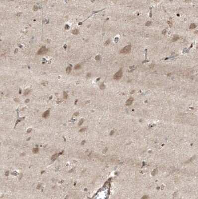 Immunohistochemistry-Paraffin HMG-CoA Reductase/HMGCR Antibody