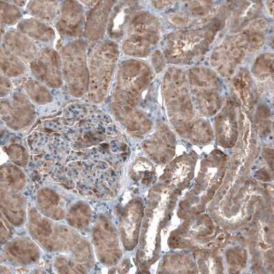 Immunohistochemistry-Paraffin HMG-CoA Reductase/HMGCR Antibody