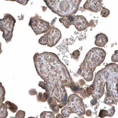 Immunohistochemistry-Paraffin HMG-CoA Reductase/HMGCR Antibody