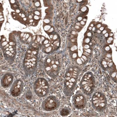 Immunohistochemistry-Paraffin: HMG-CoA Reductase/HMGCR Antibody [NBP1-91996] - Staining of human gastrointestinal shows moderate granular cytoplasmic positivity in glandular cells.