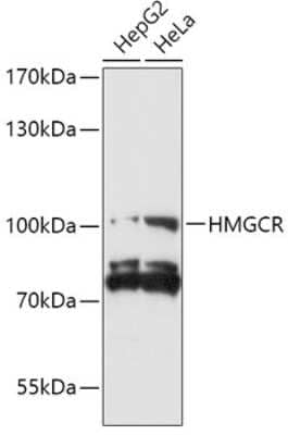 Western Blot: HMG-CoA Reductase/HMGCR Antibody [NBP3-03778] - Analysis of extracts of various cell lines, using HMG-CoA Reductase/HMGCR antibody at 1:1000 dilution. Secondary antibody: HRP Goat Anti-Rabbit IgG (H+L) at 1:10000 dilution. Lysates/proteins: 25ug per lane. Blocking buffer: 3% nonfat dry milk in TBST.