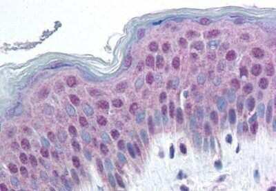 Immunohistochemistry-Paraffin: HMG14 Antibody [NBP1-02428] - Staining of human skin. Immunohistochemistry of formalin-fixed, paraffin-embedded tissue after heat-induced antigen retrieval. Antibody concentration 20 ug/ml.