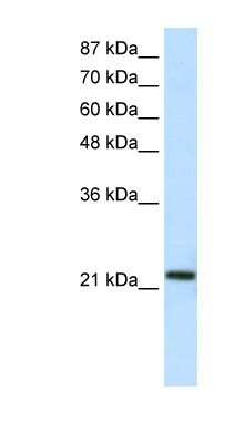 Western Blot: HMG1L10 Antibody [NBP1-80179] - Titration: 1.25ug/ml, Positive Control: HepG2 cell lysate.