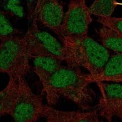Immunocytochemistry/Immunofluorescence: HMG2L1 Antibody [NBP3-17260] - Staining of human cell line AF22 shows localization to nucleoplasm & cytokinetic bridge.