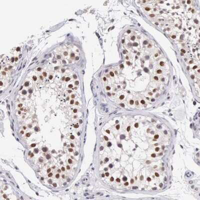Immunohistochemistry-Paraffin HMG2L1 Antibody - BSA Free