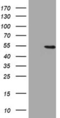 Western Blot: HMG2L1 Antibody (OTI1H10) - Azide and BSA Free [NBP2-71538] - Analysis of HEK293T cells were transfected with the pCMV6-ENTRY control (Left lane) or pCMV6-ENTRY HMG2L1.