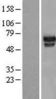 Western Blot: HMG2L1 Overexpression Lysate (Adult Normal) [NBL1-11608] Left-Empty vector transfected control cell lysate (HEK293 cell lysate); Right -Over-expression Lysate for HMG2L1.