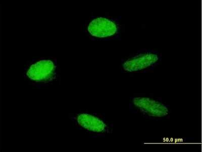 Immunocytochemistry/Immunofluorescence: HMGA1 Antibody [H00003159-B01P] - Analysis of purified antibody to HMGA1 on HeLa cell. (antibody concentration 10 ug/ml)
