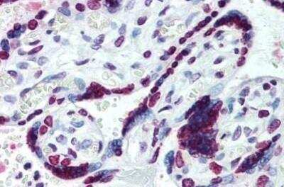 Immunohistochemistry-Paraffin: HMGA1 Antibody [NB100-56468] -  Staining of human placenta. Immunohistochemistry of formalin-fixed, paraffin-embedded tissue after heat-induced antigen retrieval. Antibody concentration 10 ug/ml.