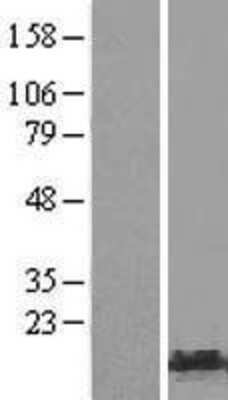 Western Blot: HMGA1 Overexpression Lysate (Adult Normal) [NBP2-09986] Left-Empty vector transfected control cell lysate (HEK293 cell lysate); Right -Over-expression Lysate for HMGA1.