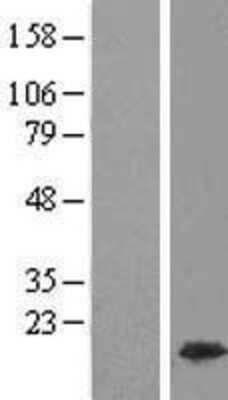 Western Blot: HMGA1 Overexpression Lysate (Adult Normal) [NBP2-09987] Left-Empty vector transfected control cell lysate (HEK293 cell lysate); Right -Over-expression Lysate for HMGA1.