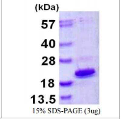 SDS-Page: Recombinant Human HMGA1 Protein [NBP1-72385]