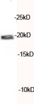 Western Blot: HMGA2 Antibody [25810002] - Analysis of HMGA2 in HeLa whole cell lysate. Image courtesy of anonymous customer product review.