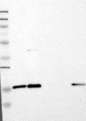Western Blot: HMGA2 Antibody [25810002] - Samples: Lane 1, Marker [kDa]: 250, 130, 95, 72, 55, 36, 28, 17, 11  Lane 2, RT-4  Lane 3, U-251MG sp  Lane 4, Human Plasma  Lane 5, Liver  Lane 6, Tonsil  Target weight [kDa]:  16, 12, 11 (splice variants) Validation score: 2 Validation description: Supportive - Band of predicted size in kDa (+/-20%) with additional bands present.