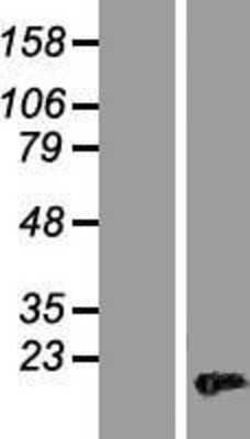 Western Blot: HMGA2 Overexpression Lysate (Adult Normal) [NBL1-11613] Left-Empty vector transfected control cell lysate (HEK293 cell lysate); Right -Over-expression Lysate for HMGA2.