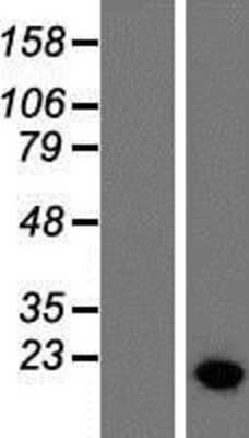 Western Blot: HMGA2 Overexpression Lysate (Adult Normal) [NBP2-07979] Left-Empty vector transfected control cell lysate (HEK293 cell lysate); Right -Over-expression Lysate for HMGA2.