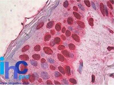 Immunohistochemistry-Paraffin: HMGB1/HMG-1 Antibody (19N15F4) - Azide and BSA Free [NBP2-80775] - Formalin-fixed, paraffin-embedded human skin stained with HMGB1 antibody at 5 ug/ml Image from the standard format of this antibody.