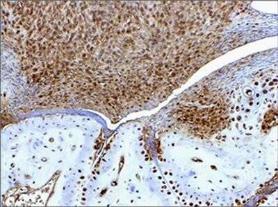 Immunohistochemistry-Paraffin: HMGB1/HMG-1 Antibody (19N15F4) - Azide and BSA Free [NBP2-80775] - IHC-P detection of HMGB1 protein in formalin-fixed, decalcified, paraffin embedded tissue sections from the paws of mouse (collagen-induced arthritis model) using HMGB1 antibody (clone 19N15F4) at a concentration of 5 ug/ml [Image courtesy of Dr Ulf Ander