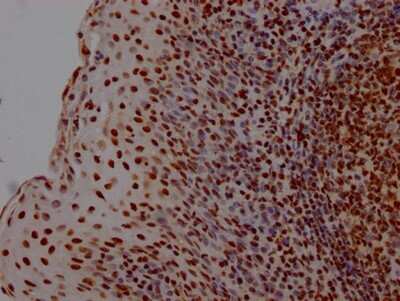 Immunohistochemistry: HMGB1/HMG-1 Antibody (1A1) [NBP3-15235] - IHC image of HMGB1/HMG-1 antibody diluted at 1:100 and staining in paraffin-embedded human tonsil tissue. After dewaxing and hydration, antigen retrieval was mediated by high pressure in a citrate buffer (pH 6.0). Section was blocked with 10% normal goat serum 30 minutes at RT. Then primary antibody (1% BSA) was incubated at 4C overnight. The primary is detected by a Goat anti-rabbit IgG polymer labeled by HRP and visualized using 0.05% DAB.