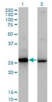 Western Blot: HMGB2 Antibody (3C7) [NBP1-69800] - Western blot of HMGB2 expression in transfected 293T cell line by HMGB2 monoclonal antibody (M03), clone 3C7.