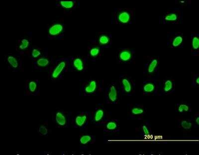 Immunocytochemistry/Immunofluorescence: HMGB2 Antibody (3D2) [NBP1-69801] - Analysis of anti-HMGB2 antibody with heLa cell.