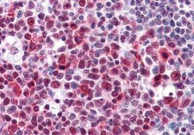 Immunohistochemistry-Paraffin: HMGB2 Antibody (3D2) [NBP1-69801] - Analysis of anti-HMGB2 antibody with human tonsil at concentration 5 ug/ml.